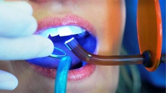 пломбирование зубов для лечения раскрошившихся зубов 